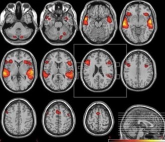 resonancia magnética